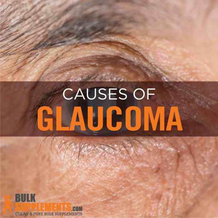Glaucoma glaucome infographics glaucoom glaukom gezichtsveld sichtweite vectorillustratie achtergrond symptoms nervo occhi visivo ottico infographie vecteur champ sintomi atrofia dans